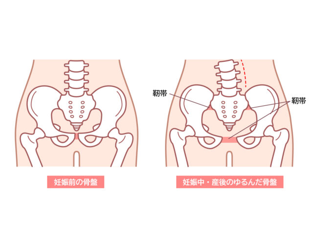産後骨盤矯正なら整骨院｜体に優しい施術で骨盤から整える