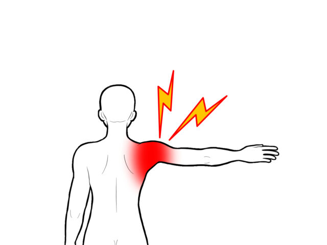 肩が上がらない…年齢のせいにしていませんか？整骨院で根本改善を実現