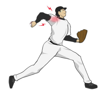 スポーツ障害の改善から実力アップまで｜学生・社会人を徹底サポート- ゼロスポ鍼灸・整骨院 小田原